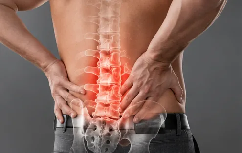 Dolor lumbar persistente tras una cirugía de columna previa